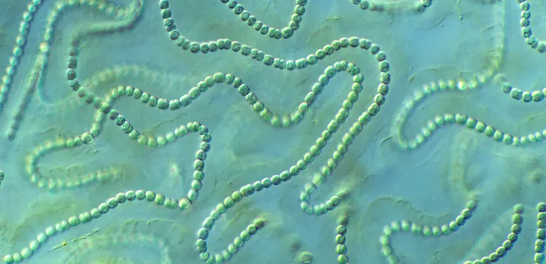 Blue-Green Algae (Microcystis aeruginosa)